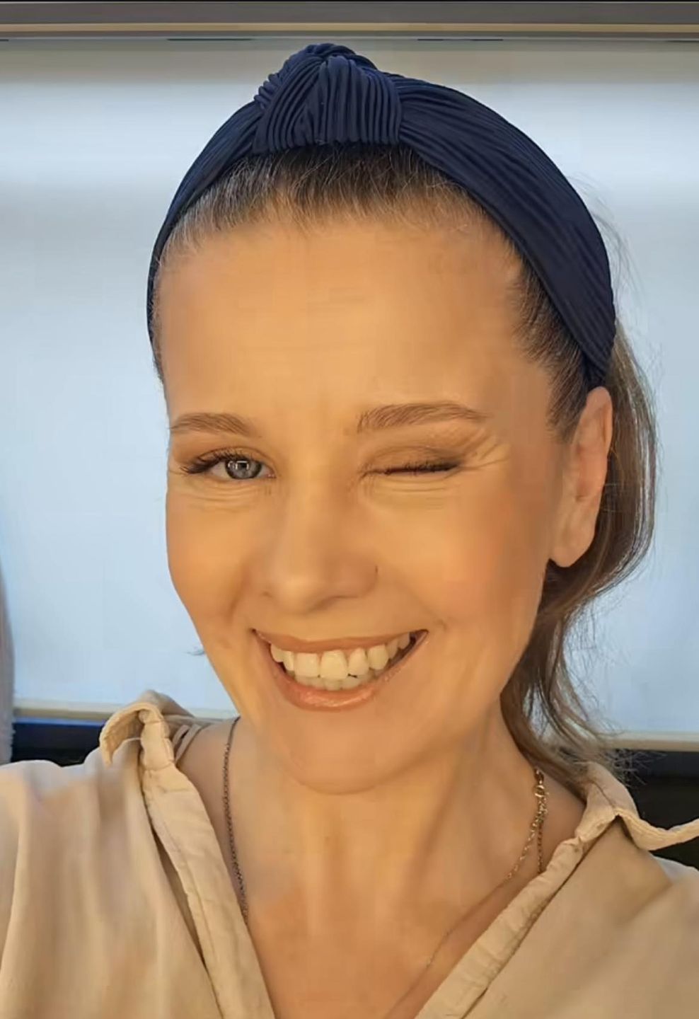 Anna Powierza wycięła nadmiar skóry na powiekach