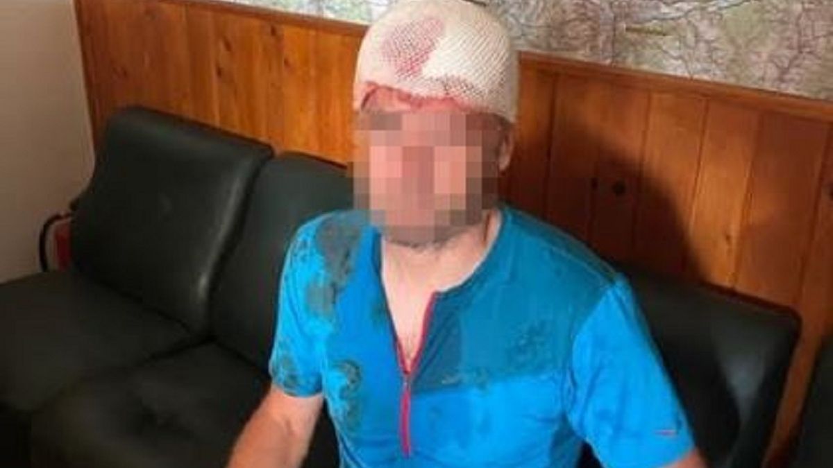 Niedźwiedź zaatakował ratownika górskiego (fot. Horská záchranná služba)