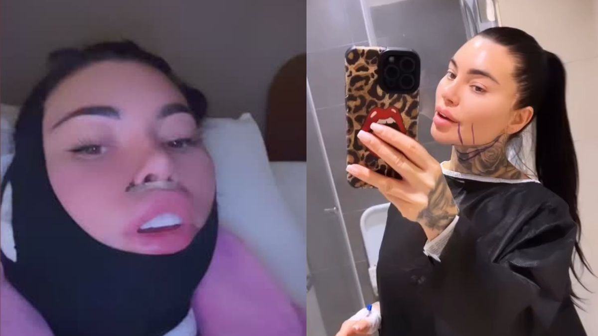 Anna Renusz z "Królowych życia" przeszła mnóstwo poprawek urody