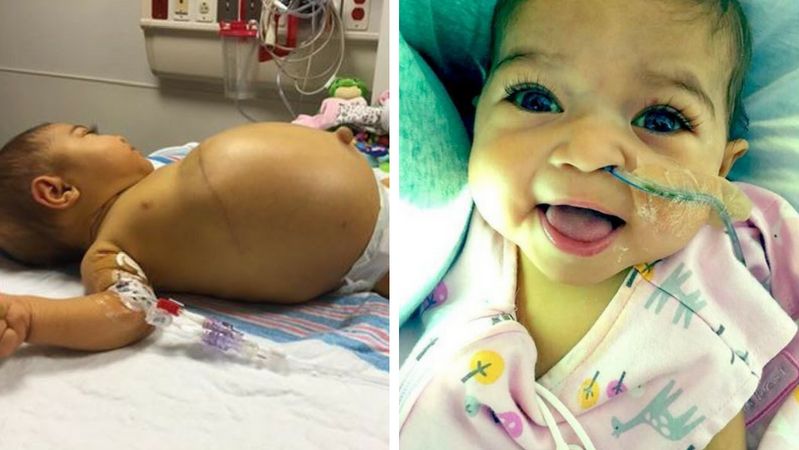 Brzuszek dziewczynki rósł w zastraszającym tempie