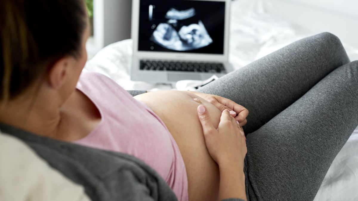 Sirenomelia (syndrom syreny) jest diagnozowana w trakcie badania USG w 14. tygodniu ciąży.