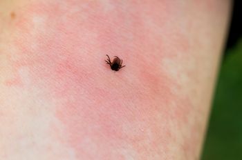 Zagotuj i wylej w ogrodzie. Dla kleszczy to najgorszy fetor