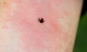 Zagotuj i wylej w ogrodzie. Dla kleszczy to najgorszy fetor