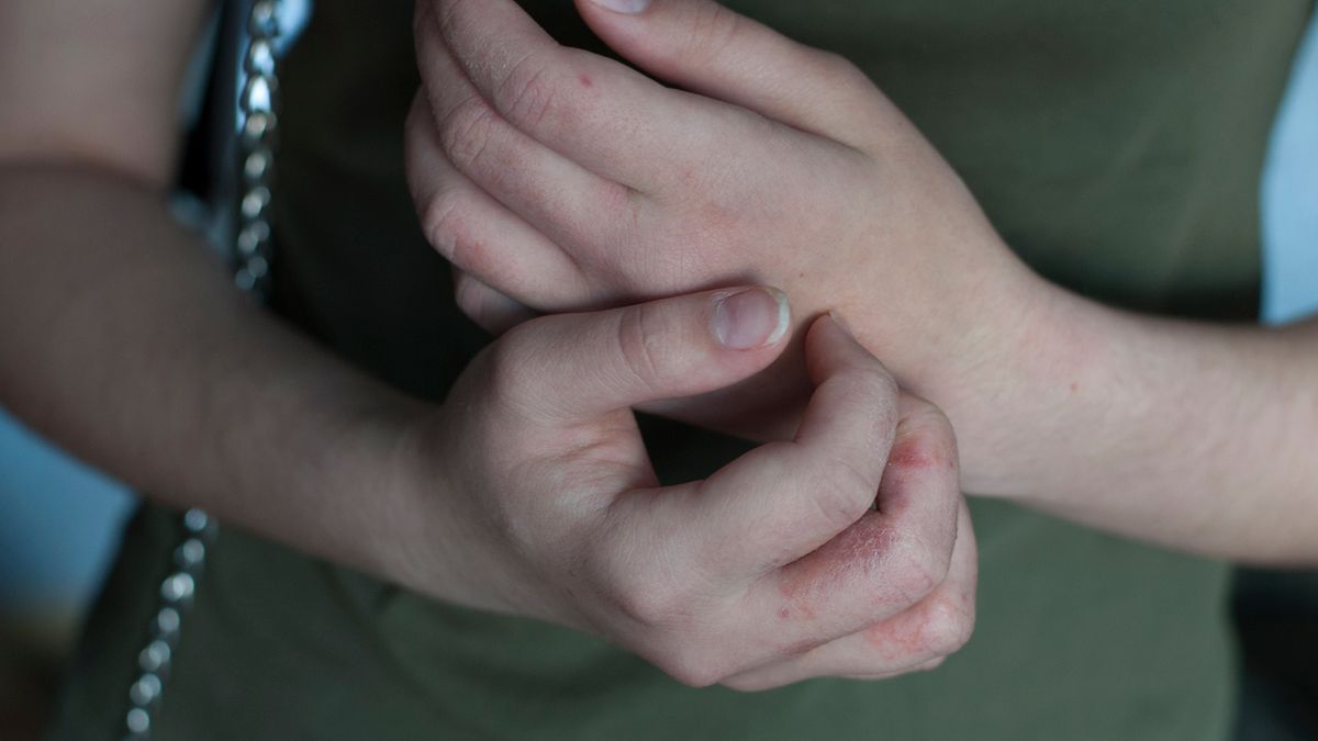 Kwasica ketonowa - ketogeneza, objawy, leczenie