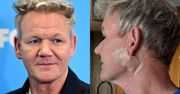 Gordon Ramsay ujawnił, że miał raka skóry. Żartował: "To nie jest lifting twarzy"