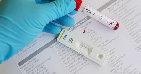 Niepozorne dolegliwości, które mogą być objawem nowotworu