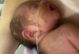 Dziewczynka urodziła się trzy tygodnie przed terminem. Jej ciało pokrywały czarne włoski