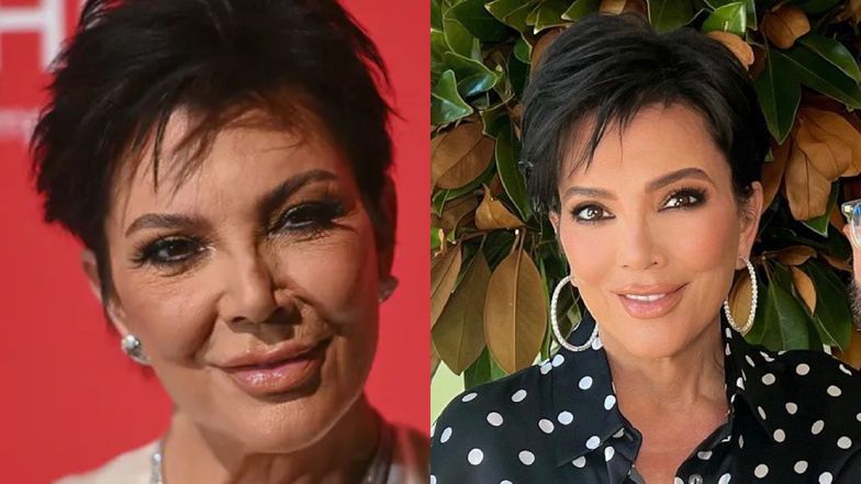 Fani zszokowani wyretuszowaną twarzą Kris Jenner