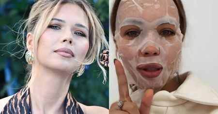 Sandra Kubicka zrelacjonowała GRUPOWY wypad na botoks. Ekspertka z niepokojem: "Wzmacnia presję wyglądu"