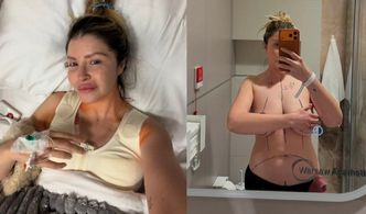 Przedsiębiorcza Ciocia Liestyle przeszła redukcję biustu w ramach barteru: "Spełniłam MARZENIE" (ZDJĘCIA)