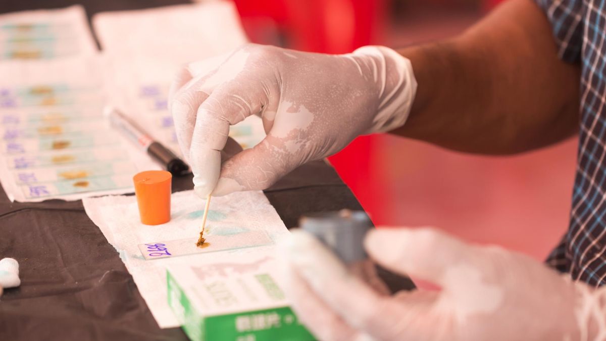 Kał pobierany jest przed rozpoczęciem leczenia, aby nie doszło do zafałszowania wyniku.