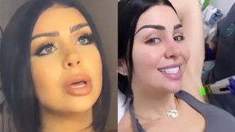 Poleciała po nowe zęby do Turcji: "ŻYJĘ W CIĄGŁYM STRACHU, że wypadną mi licówki!". Nie do zniesienia miał być też ich zapach...