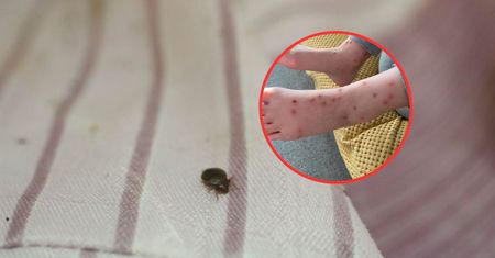 Dziecko obudziło się pogryzione. Przeraziła się, gdy sprawdziła łóżko