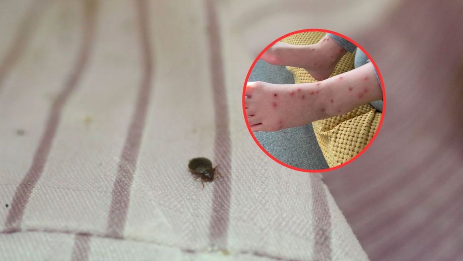 Dziecko obudziło się pogryzione. Przeraziła się, gdy sprawdziła łóżko