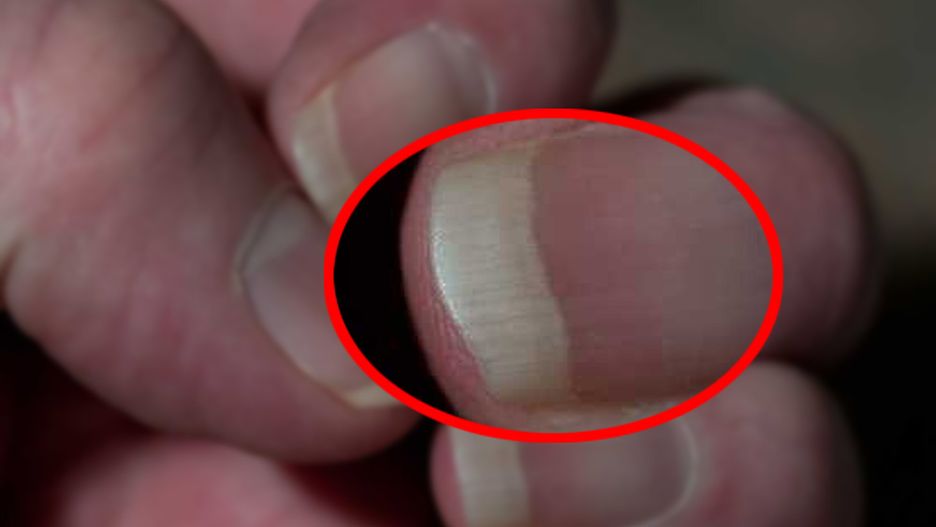 Stan paznokci może świadczyć o stanie zdrowia całego organizmu