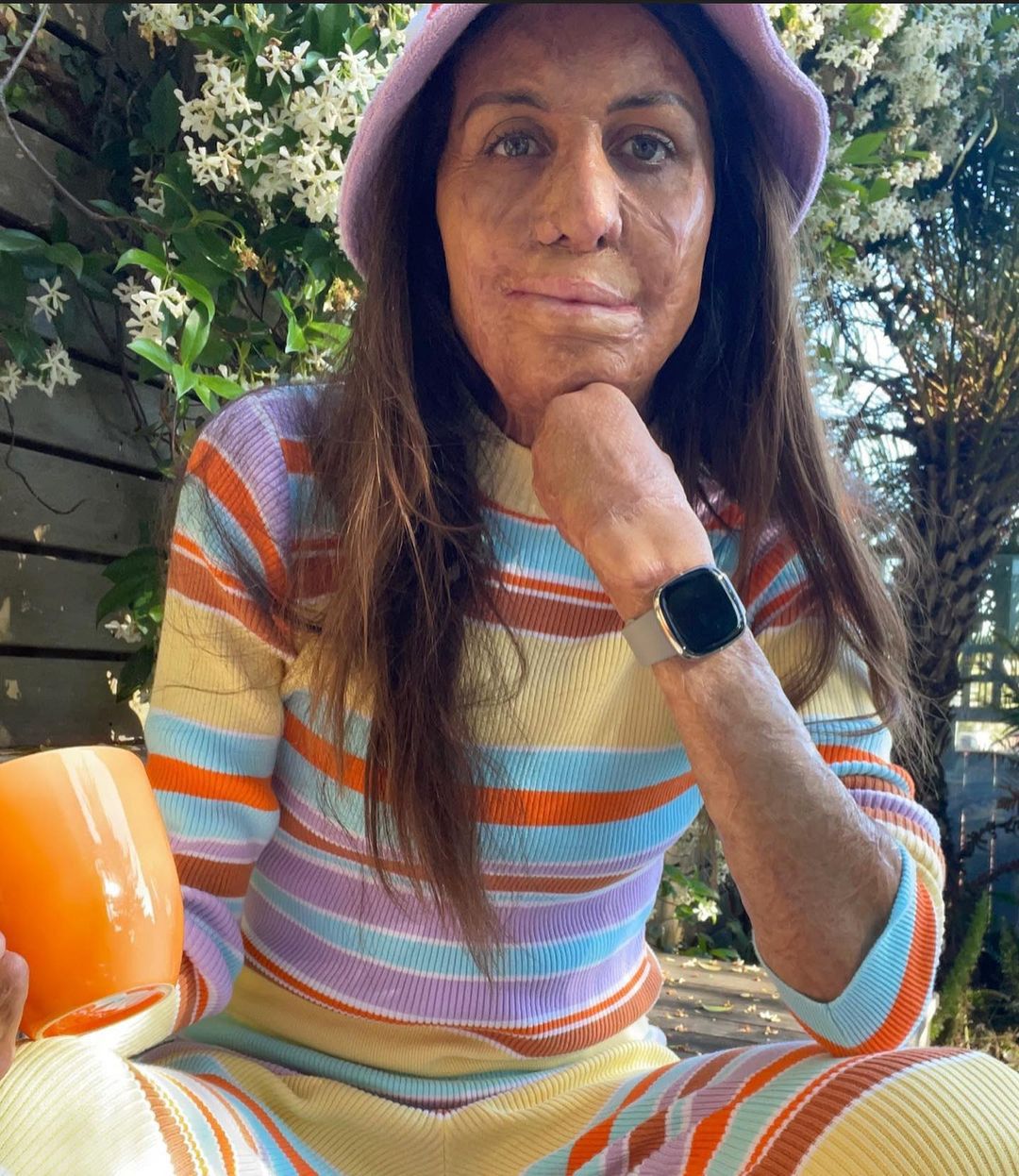 Turia Pitt