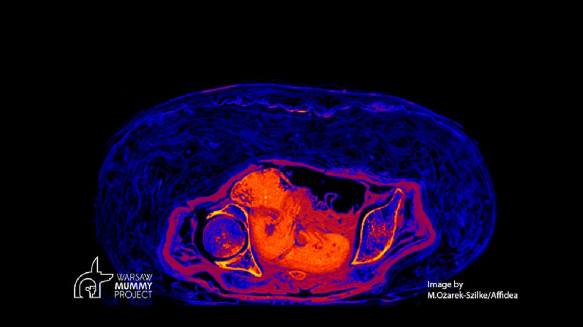 Egipska mumia ciężarnej kobiety. To pierwszy taki przypadek na świecie