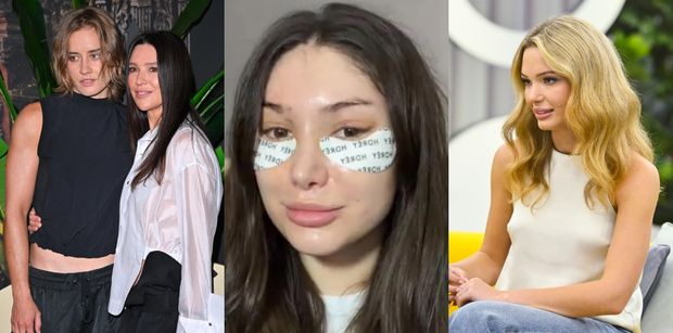 Influencerki są ofiarami absurdalnych standardów piękna, ale same nakręcają tę spiralę dalej: "LIFTING 27-LATKI zaprasza do chirurgów młode dziewczyny" (Okiem Pudelka)