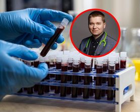 Przed badaniem odstaw ten suplement. Endokrynolog ostrzega, że może fałszować wyniki