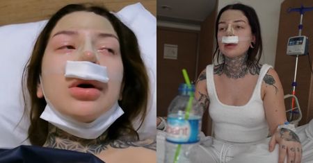 Marcysia z Ekipy Friza ZOPEROWAŁA NOS w Turcji! "Strasznie mnie boli, oczy mi łzawią"