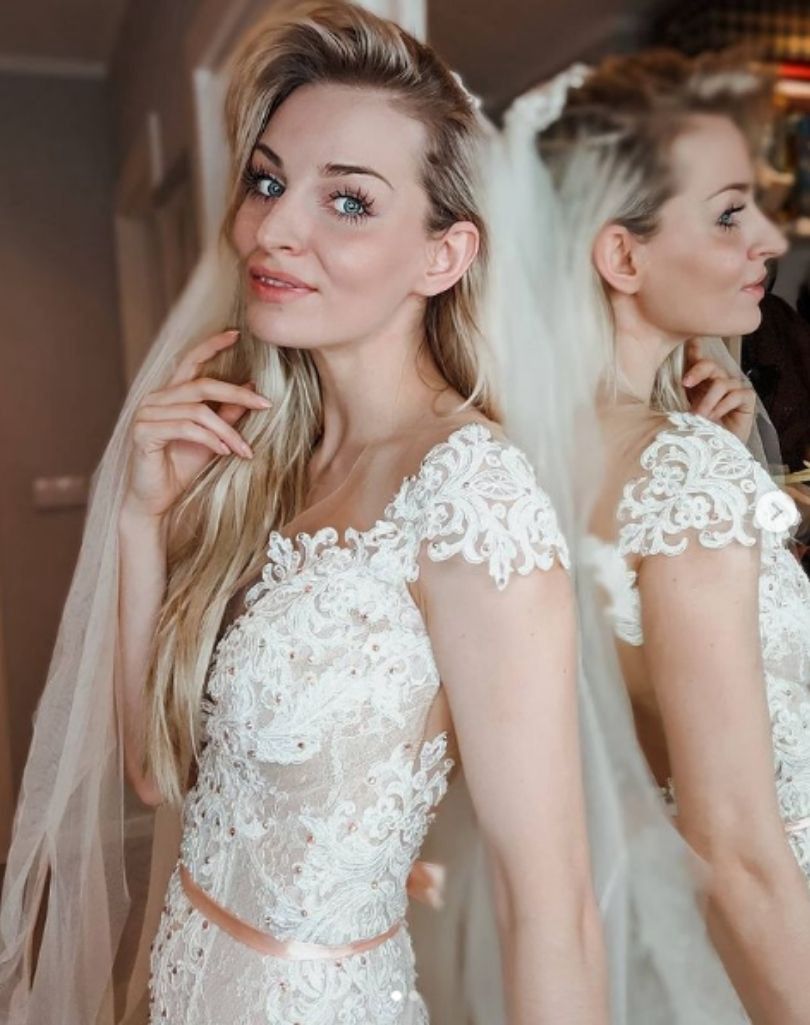 Anita ze "Ślubu od pierwszego wejrzenia" zafundowała sobie upiększający zabieg"