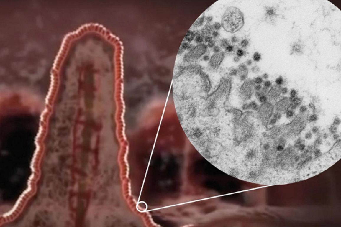 Koronawirus daje objawy ze strony żołądka i jelit