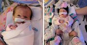 Nie mogą wyleczyć 2-tygodniowego dziecka, bo nigdy nie spotkali się z tą chorobą. "To medyczna tajemnica" - przyznają lekarze
