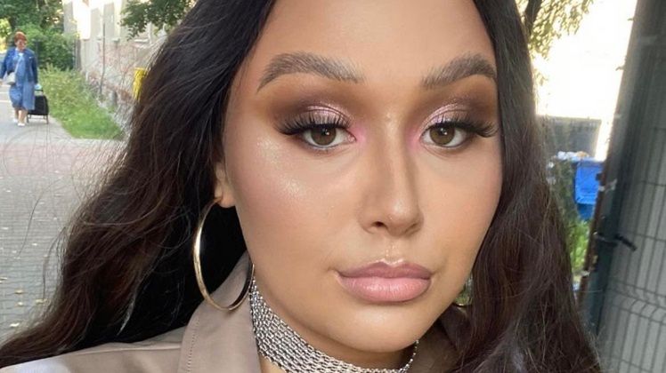 Oliwka Brazil pokazała świeżo ostrzyknięte usta