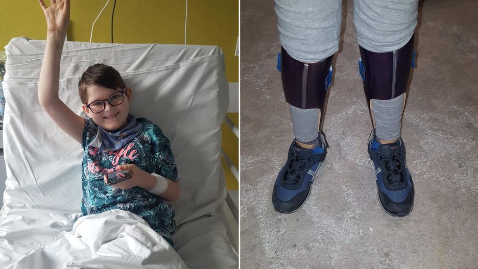 Bartuś ma szanse na zdrowe nogi. Rodzina prosi o pomoc