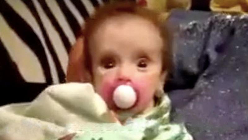 Dziewczynka niedługo po tym, jak znaleziono ją w szafie