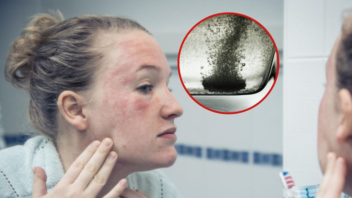 Stosujesz "wapno" na objawy alergii? Farmaceutka nie ma dobrych wieści