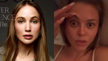 Joanna Opozda zobaczyła "nową twarz" Jennifer Lawrence i się załamała. "TO WYGLĄDA DZIWNIE"