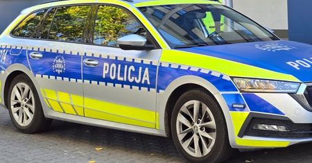 Atak psa w Płocku. Kobieta stanęła w obronie swojego pupila i trafiła do szpitala