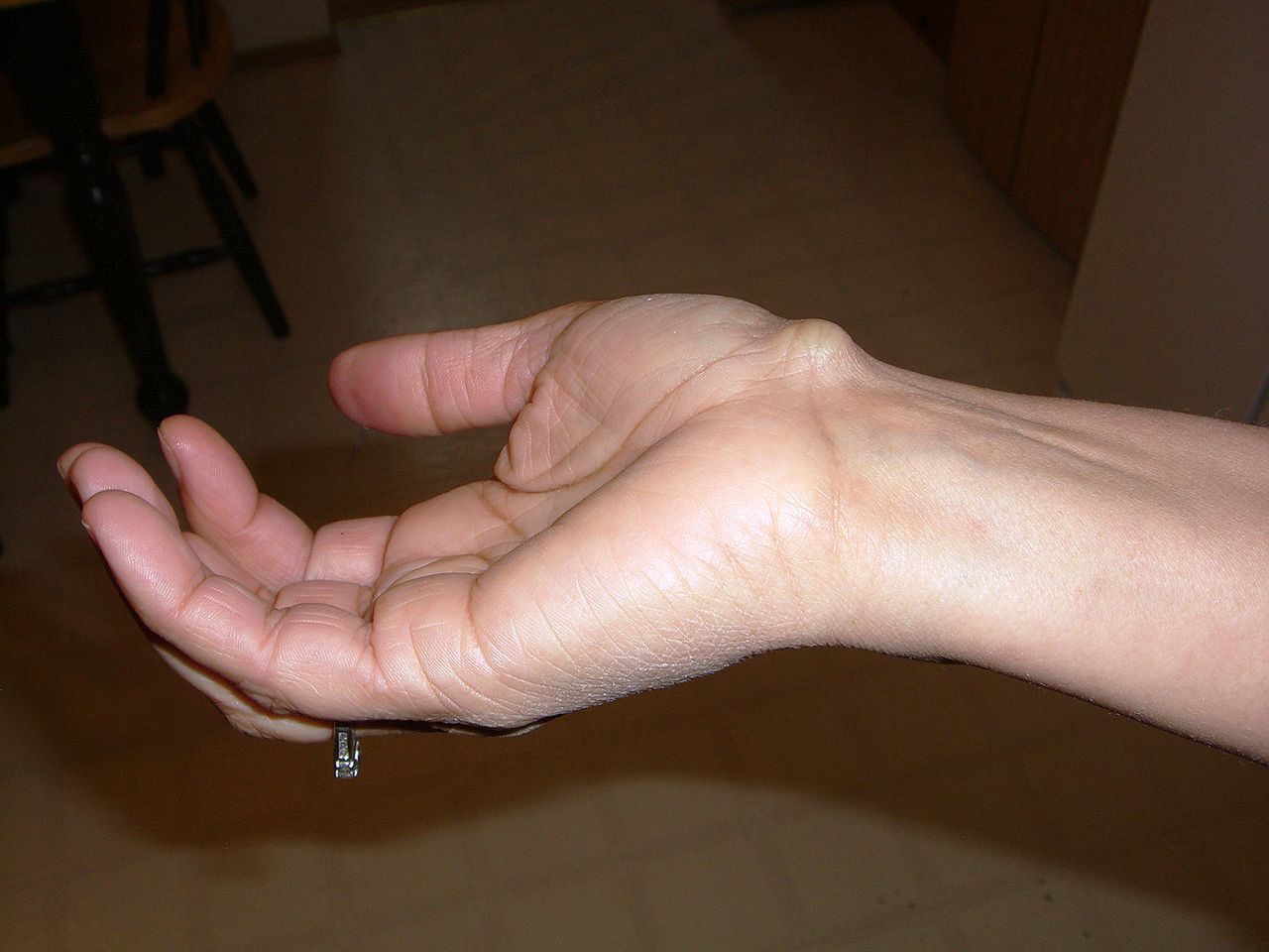 Ganglion