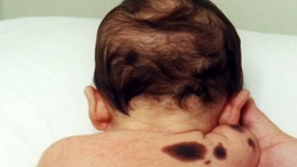 Zdjęcie ilustracyjne