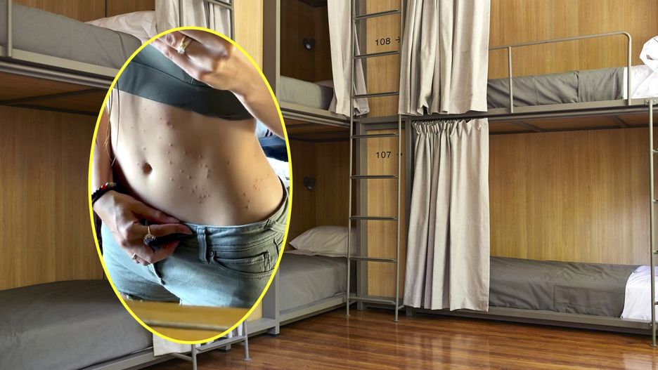 Podróżniczka radzi, jak uniknąć pogryzień przez pluskwy