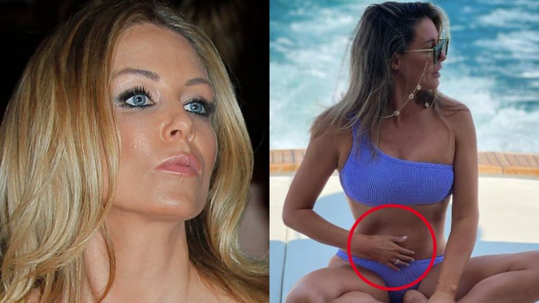 Małgorzata Rozenek odpowiada na zarzuty o retusz