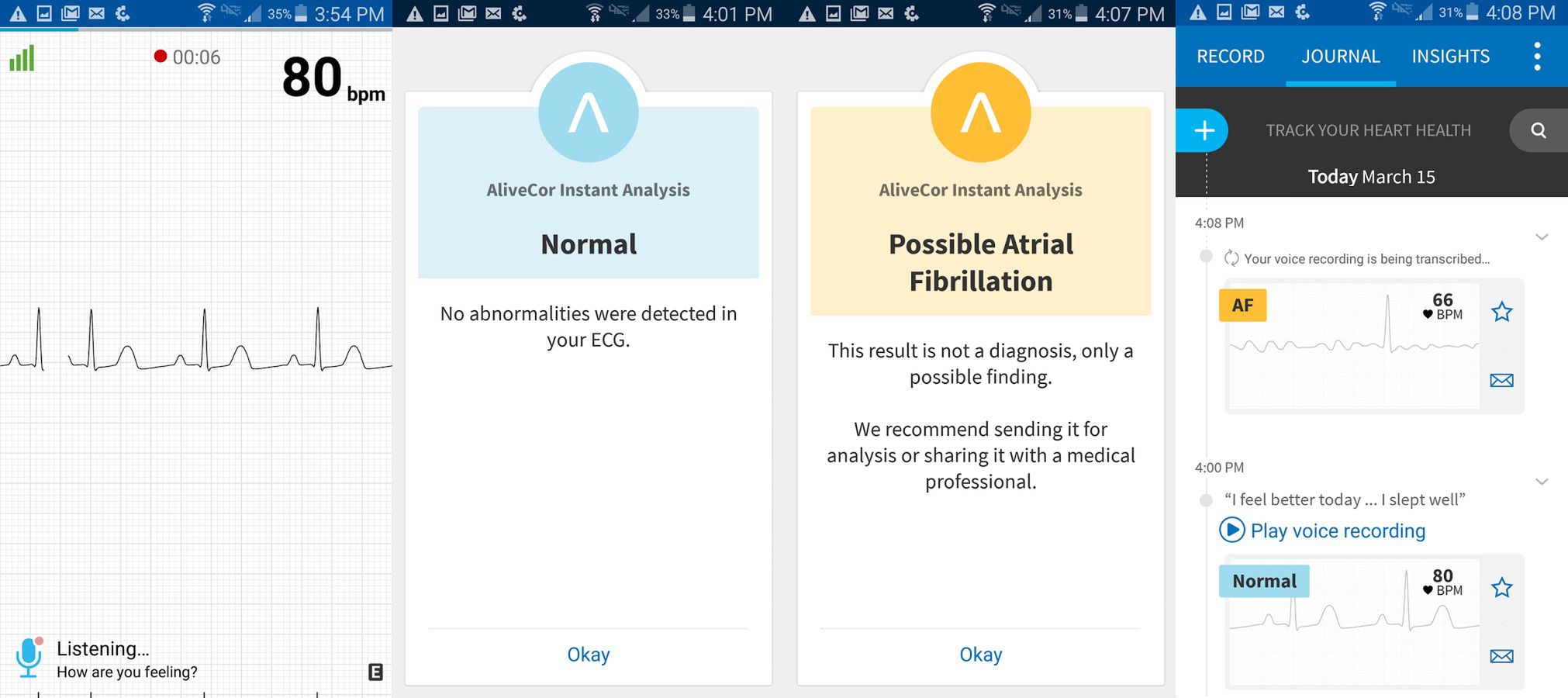 Apple Watch z opaską, która umożliwi pomiar EKG. Czy można ufać takim akcesoriom? Pytamy specjalistę 4