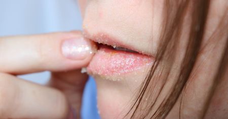 Skuteczny peeling do ust. Domowy (i tani!) sposób na zadbane i gładkie usta