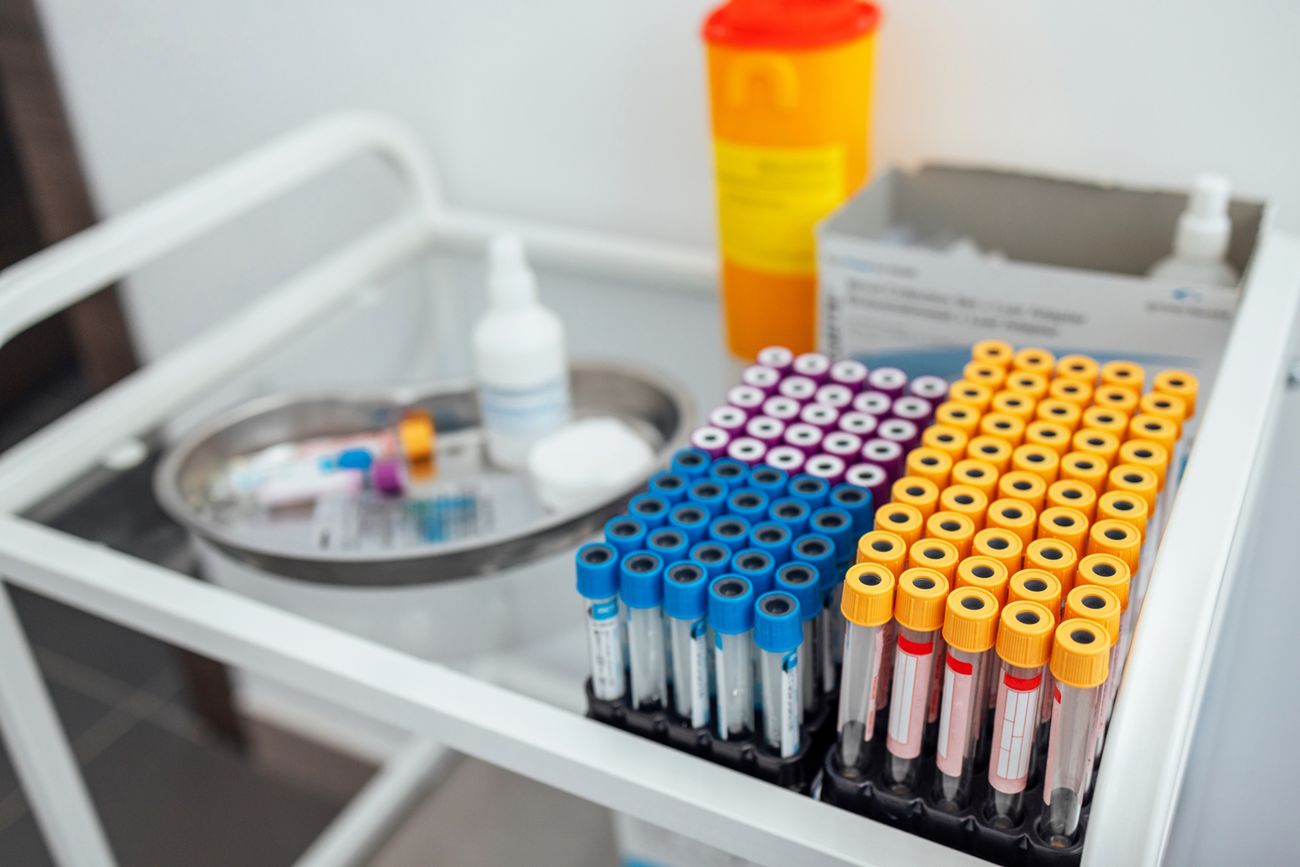 Oprócz badania per rectum mężczyźni regularnie poddawali się oznaczeniom PSA w surowicy