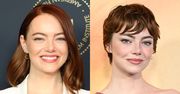 Emma Stone i jej "nowa twarz" pod lupą lekarza medycyny estetycznej. Co - jego zdaniem - mogła sobie poprawić?