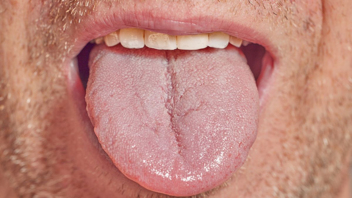 Zwróć uwagę na wygląd języka. Tak może objawiać się choroba