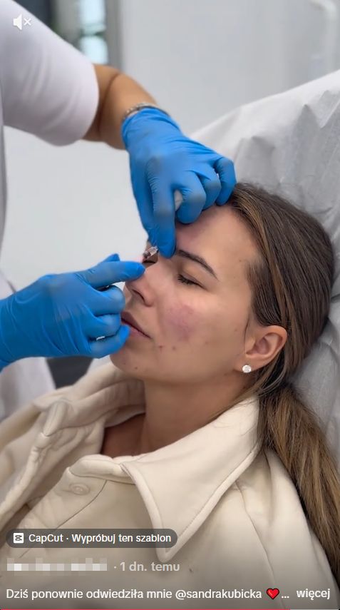 Sandra Kubicka w gabinecie medycyny estetycznej