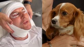 Pies NIE POZNAŁ Krzysztofa Gojdzia po liftingu za 150 tysięcy złotych: "Zaczął mnie wąchać"