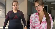 Popularna influencerka przeszła niesamowitą metamorfozę. Dzięki operacji schudła ponad 35 kilogramów