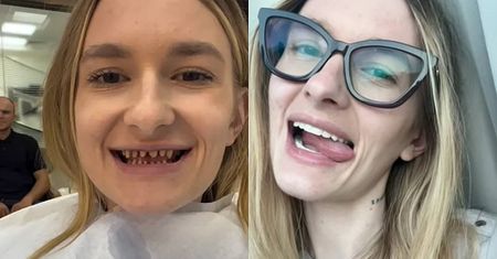 Joanna z "Rolnik szuka żony" pognała do Turcji po nowe zęby. W Polsce jest za drogo