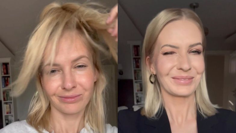 Internautka posądziła Edytę Pazurę o majstrowanie przy policzkach!