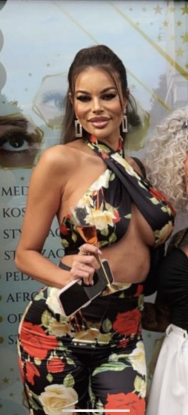 Justyna Gradek i jej eks Karol Miśkiewicz wspólnie promują salon medycyny estetycznej. Przekonali was?