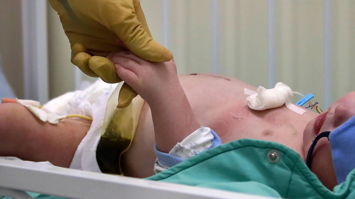 Coraz więcej dzieci cierpi na tajemniczą chorobę powiązaną z koronawirusem