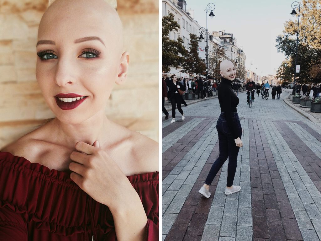 ''Doszłam do momentu, w którym poczułam, że peruka mnie ogranicza. Chciałam być sobą'' 